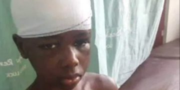 PHOTO: Woman arrested for drilling nails and using hot iron on her 10-year-old domestic help's head in Enugu