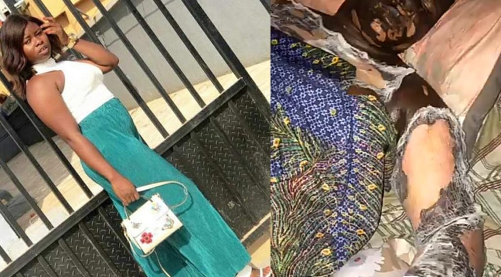 PHOTOS: Woman dies after suffering burns while answering call close to a gas cannister