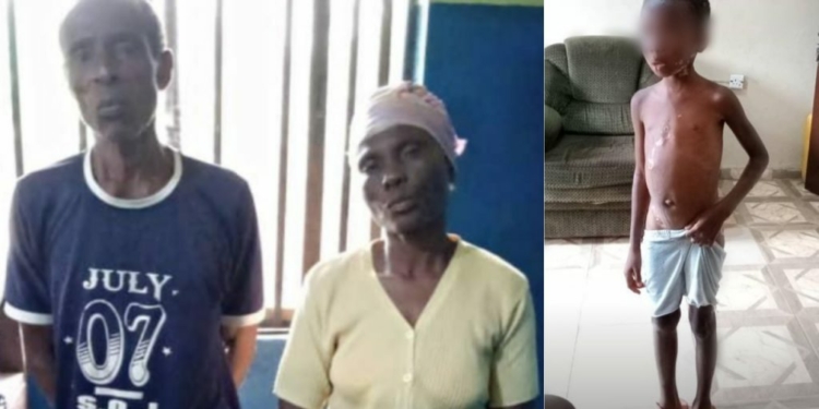Ogun police arrest couple for allegedly burning 7-yr-old granddaughter with hot robber