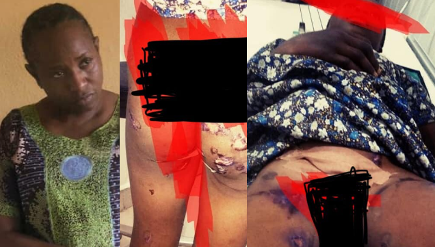 Deaconess arrested after burning ward's private part, inflicting other injuries in Kaduna