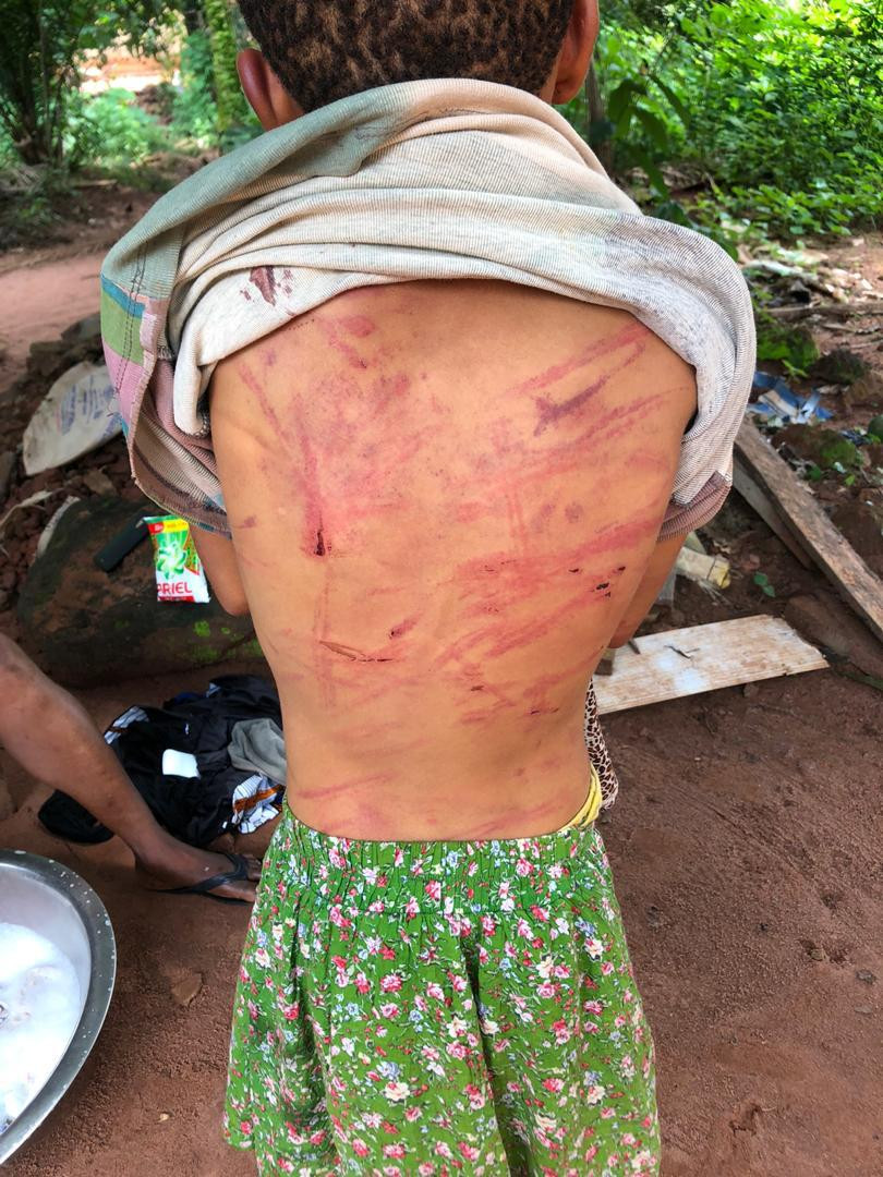 Couple arrested for brutalising their 12-year-old daughter in Enugu