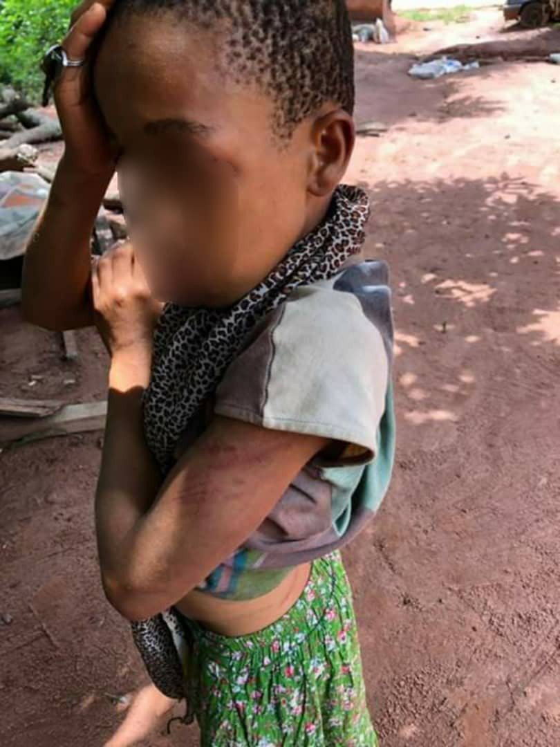 Couple arrested for brutalising their 12-year-old daughter in Enugu