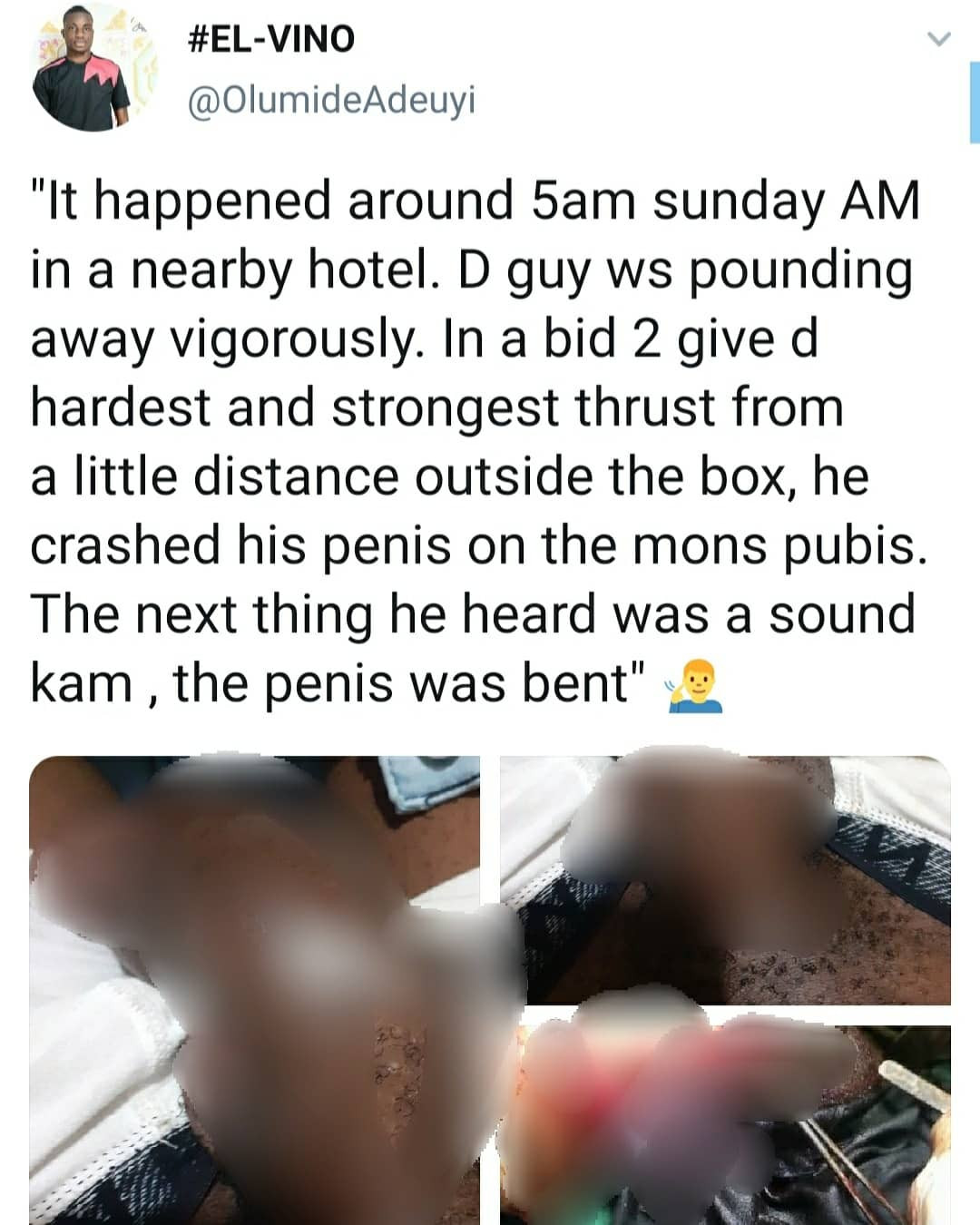 Nigerian man suffers penile fracture while engaging in rigorous sex with his partner (graphic photos)