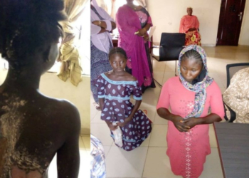 Woman arrested for pouring hot water on step-sister in Kogi