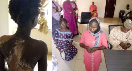 Woman arrested for pouring hot water on step-sister in Kogi