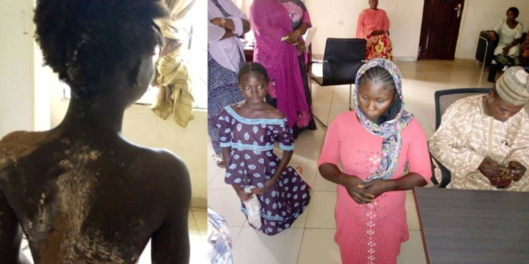 Woman arrested for pouring hot water on step-sister in Kogi