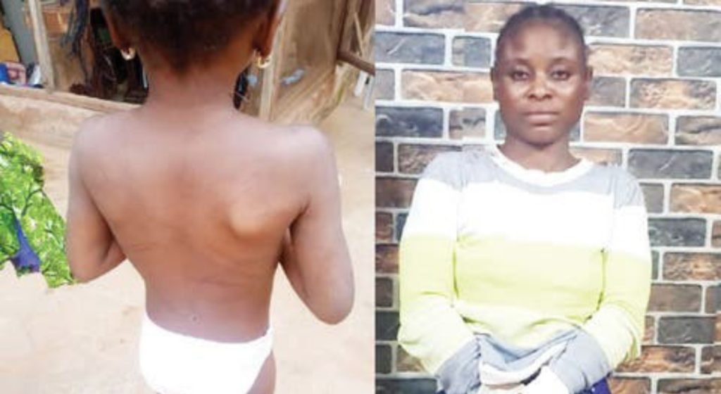 Father, stepmother torture six-year-old Ogun girl with nails