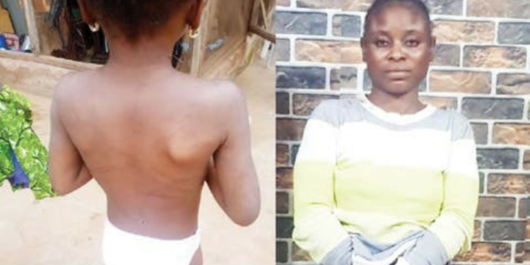 Father, stepmother torture six-year-old Ogun girl with nails
