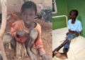 Epileptic boy chained for two years by his family, rescued in Kebbi