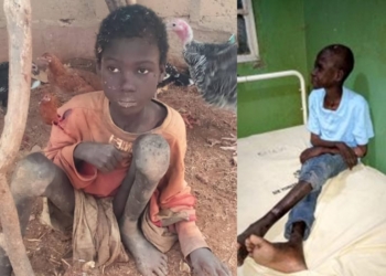 Epileptic boy chained for two years by his family, rescued in Kebbi