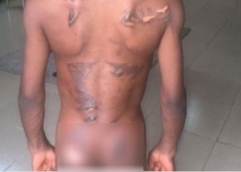 8-year-old boy allegedly scarred with hot iron for eating his aunt's N50 groundnut in Calabar