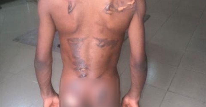 8-year-old boy allegedly scarred with hot iron for eating his aunt's N50 groundnut in Calabar
