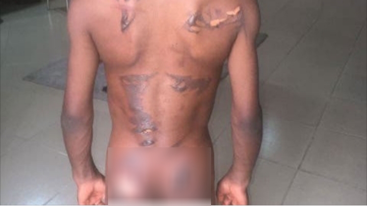 8-year-old boy allegedly scarred with hot iron for eating his aunt's N50 groundnut in Calabar