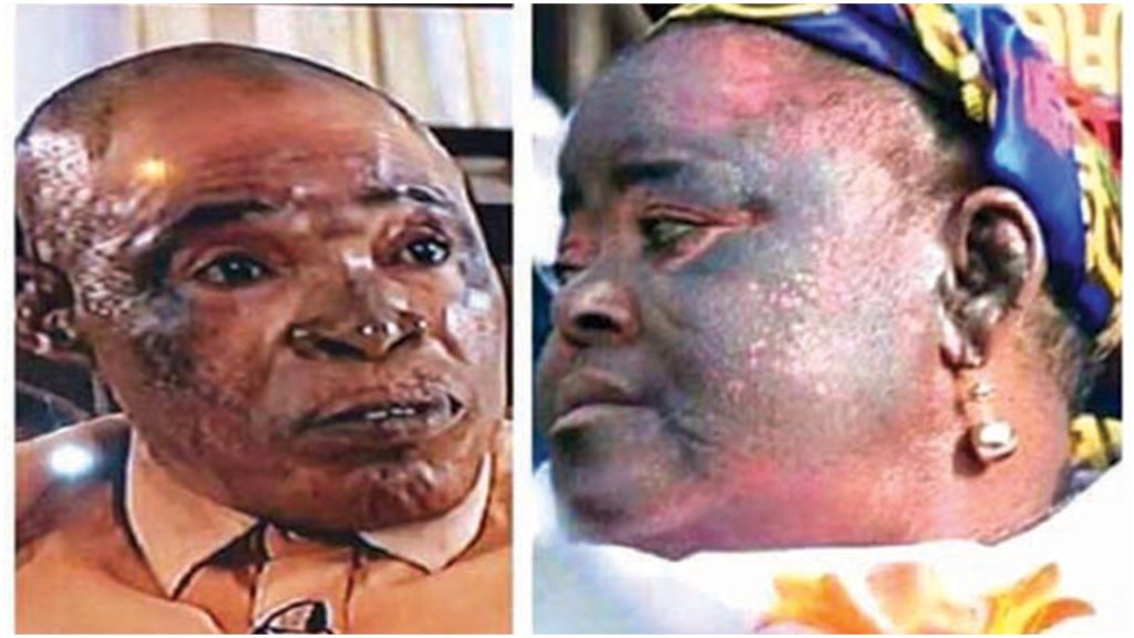 NAFDAC bans popular bleaching skincare product in Nigeria