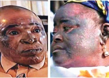 NAFDAC bans popular bleaching skincare product in Nigeria