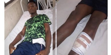 Policeman damages 19-year-old boy's leg for impregnating a girl