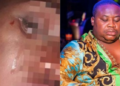 The lady assaulted by Cubana Chief priest at Owerri club cries out