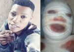I saw death when ex-convict poured hot oil on me — Kwara puff puff seller
