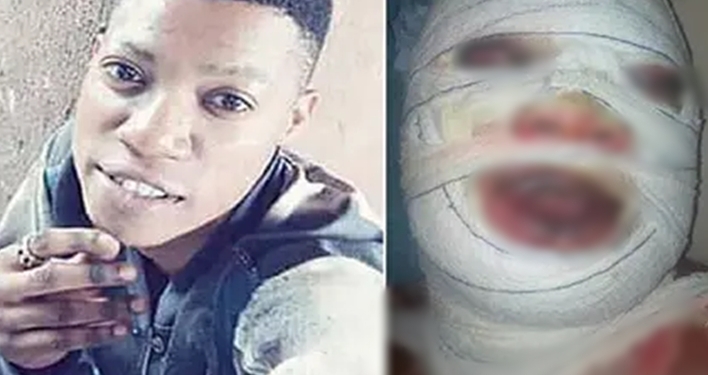 I saw death when ex-convict poured hot oil on me — Kwara puff puff seller