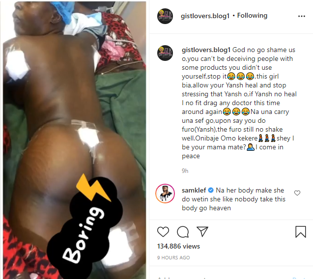 BBNaija's Khloe exposed on surgery bed during butt and hips enlargment