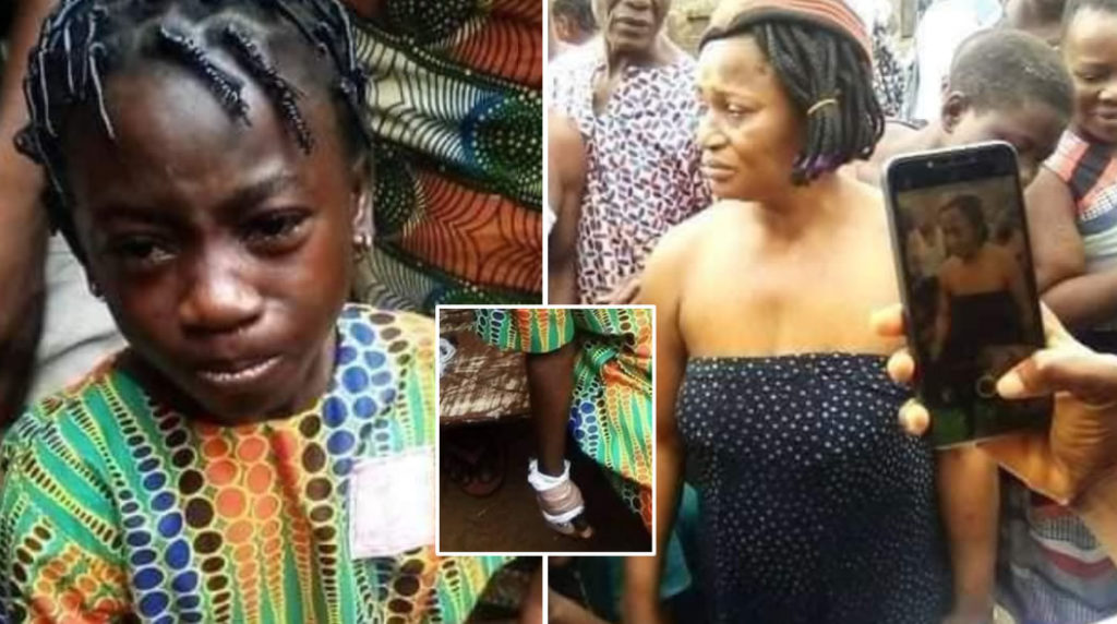 PHOTO: Woman chops off her niece' finger in Onitsha