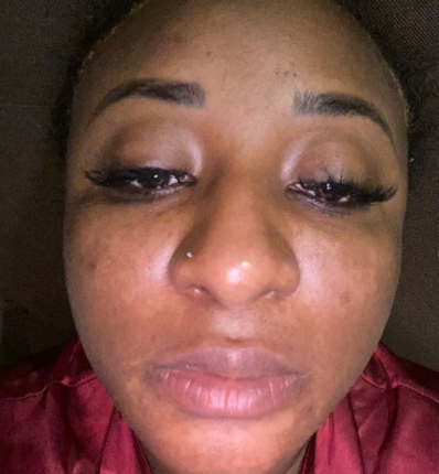 "I've been depressed for a couple of days", Ini Edo says as she shares photo of her damaged skin