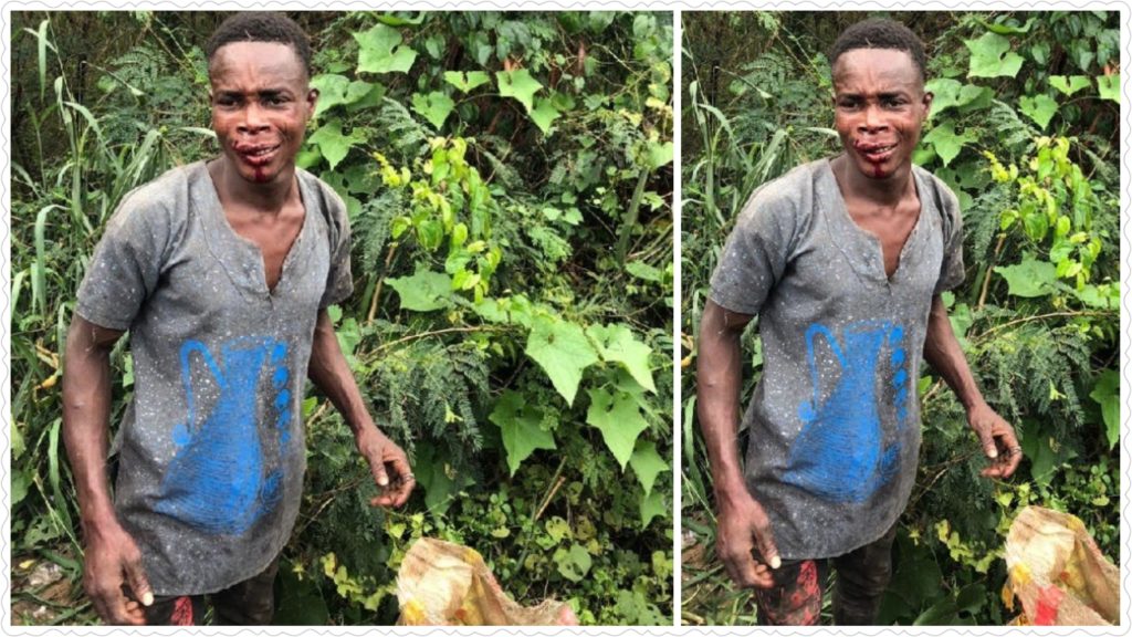 Young man escapes death after being attacked by suspected ritual killer in Ibadan