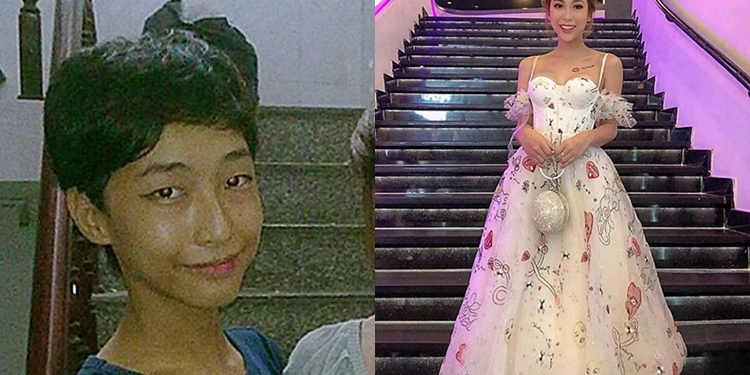 Before and after photos of 23-year-old man who transitioned to female after undergoing surgeries and injecting hormones and reshaping male organ