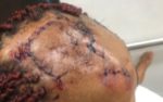 Brother allegedly brutalizes sister over father's property in Enugu