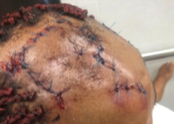 Brother allegedly brutalizes sister over father's property in Enugu
