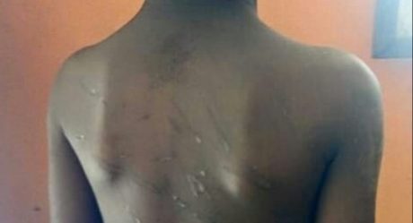 PHOTOS: Couple torture 10-yr-old son for taking food from pot without permission in Rivers