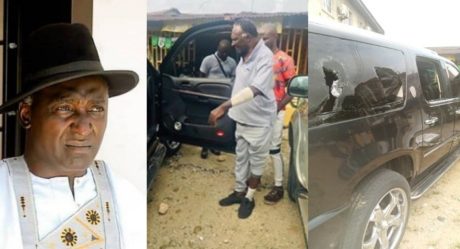 PHOTOS: Veteran Actor, Clem Ohameze Reportedly Attacked By Hoodlums In Uyo