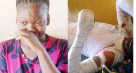 17-yr-old Benue girl who set her boyfriend ablaze recounts ordeal, says he made her abort three pregnancies