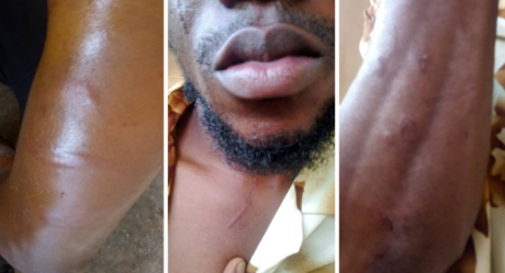 PHOTOS: Journalist narrates how Imesi-Ile youths attacked him while filming festival