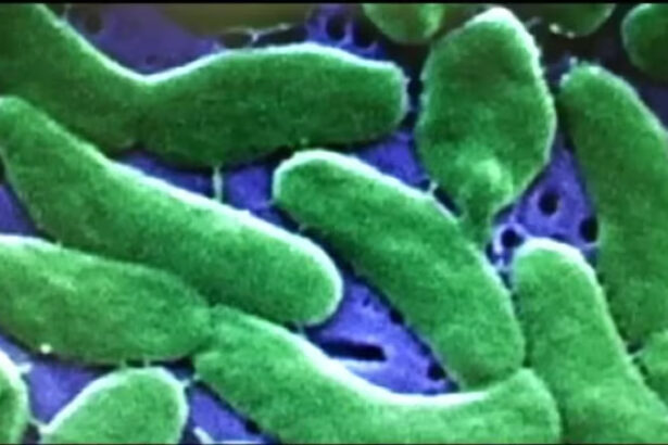 louisiana vibrio vulnificus outbreak