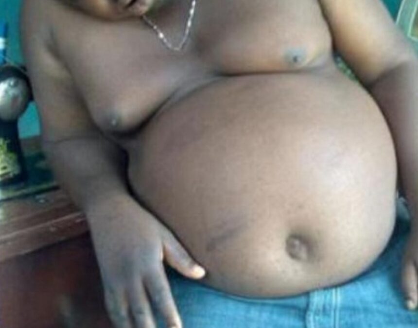 Five factors that can cause a pot belly
