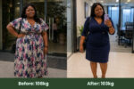 Image showing a HueBeautyGlam client who lost 5kg with Tizaro injection