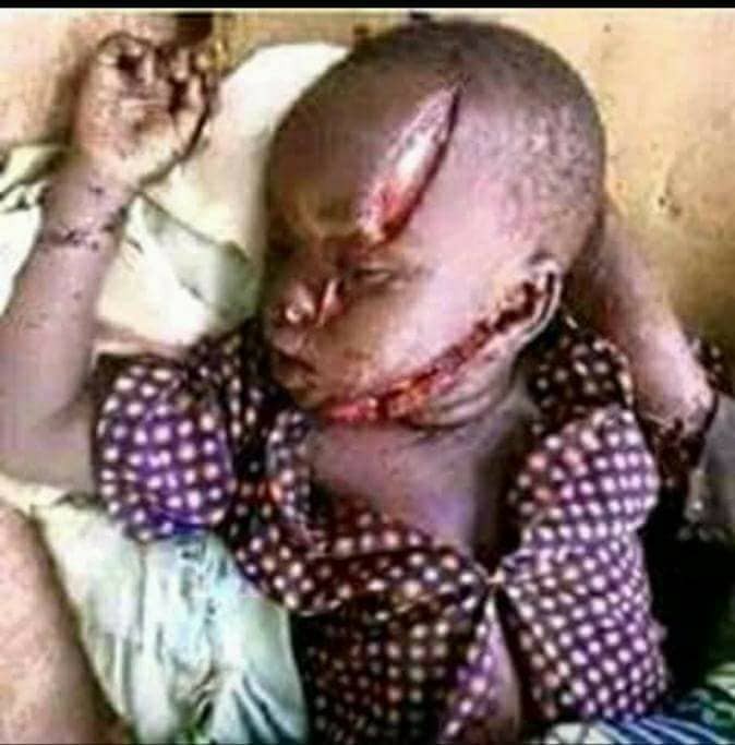 Heartbreaking photos from attack carried by unknown gunmen in Plateau state(graphic)