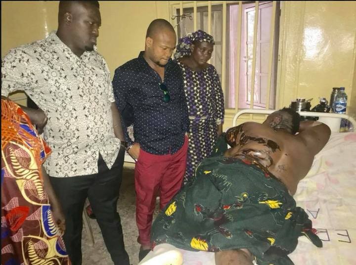 Graphic Photos:?Plus-Size woman bathed with acid by her younger ex-lover in Anambra State